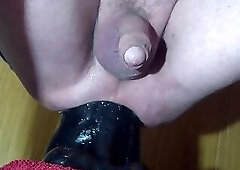 Anal madness - ep. 2