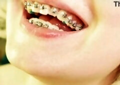 Eating in braces - close up video - food fetish - mouth tour