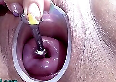 Japanese Extreme Cervix Fucking