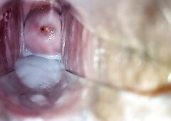 Cum inside cunt close-up speculum