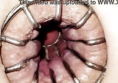 Reneenicolecd - update #thirty - Gape anal stretch cage - Apr nineteen, 2026