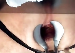 my hole is open with specula giant