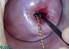Extreme Cervix Playing with Insertion Metal Chain in Ut
